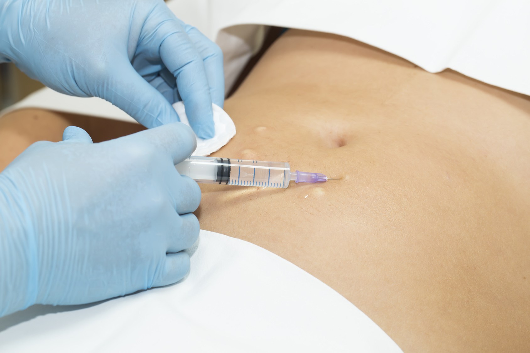What is meso injection?